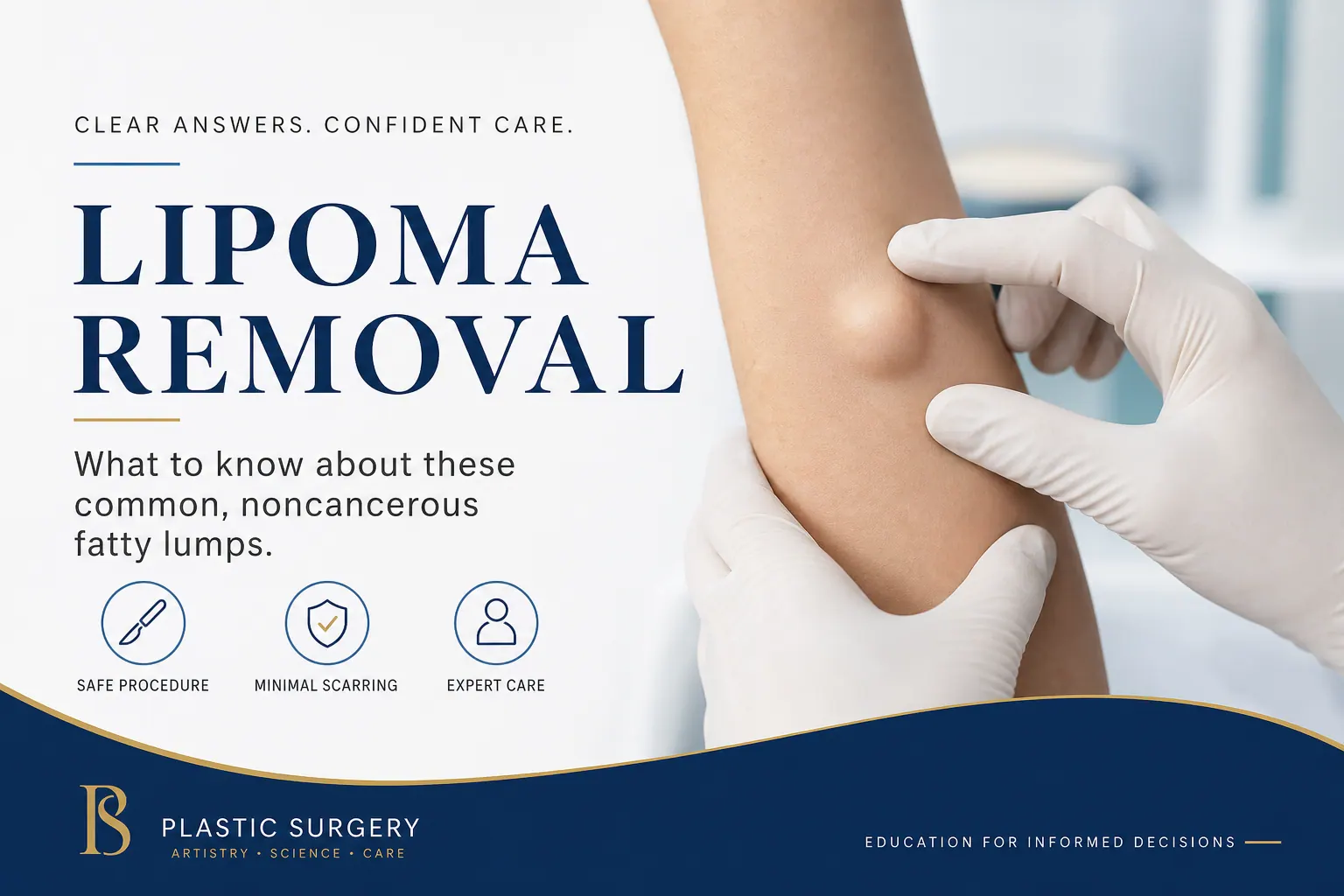 Lipoma and sebaceous cyst removal day-care surgery service by Dr. Ram Prabhu