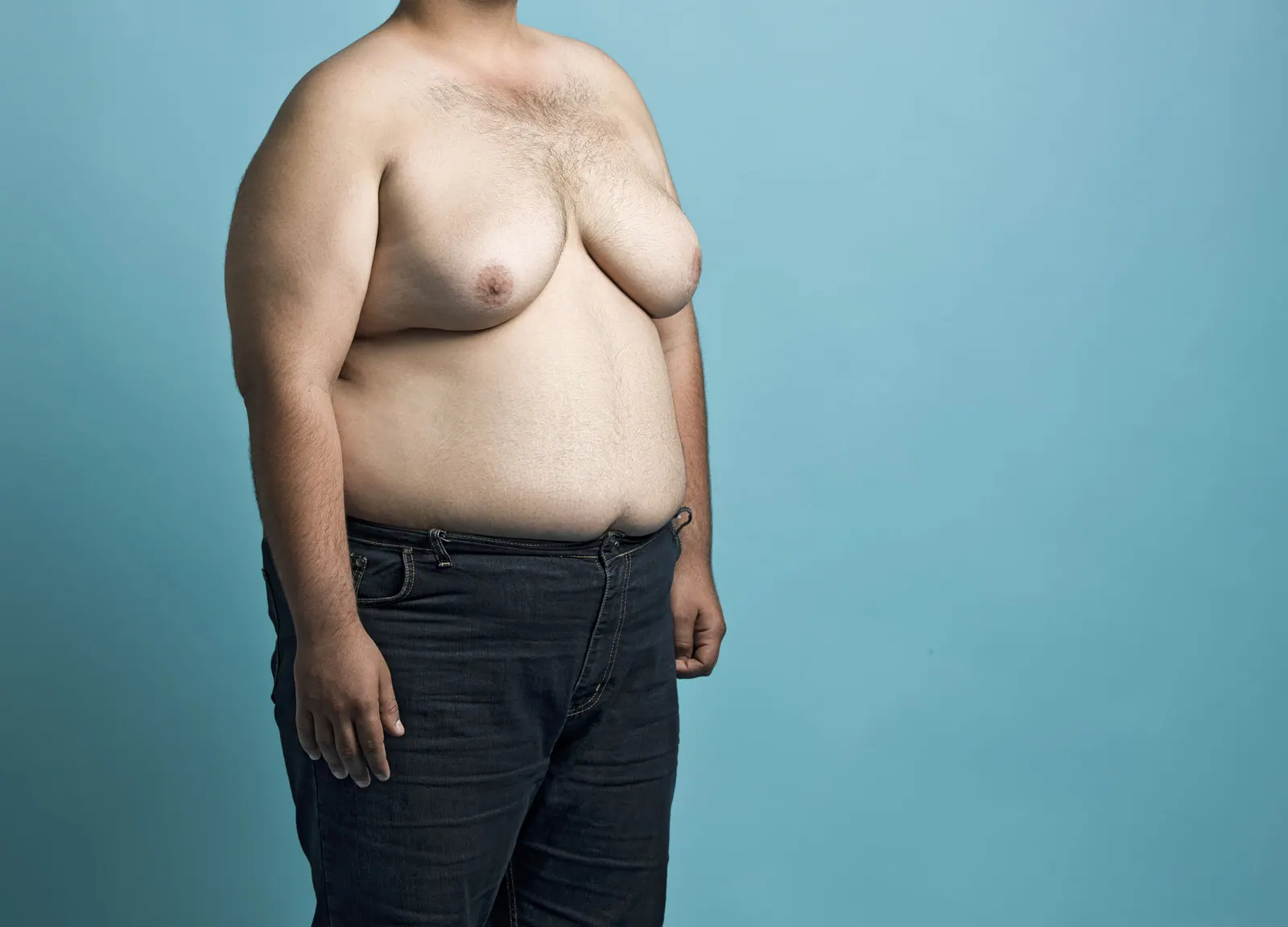 Male chest contouring — gynecomastia treatment overview.