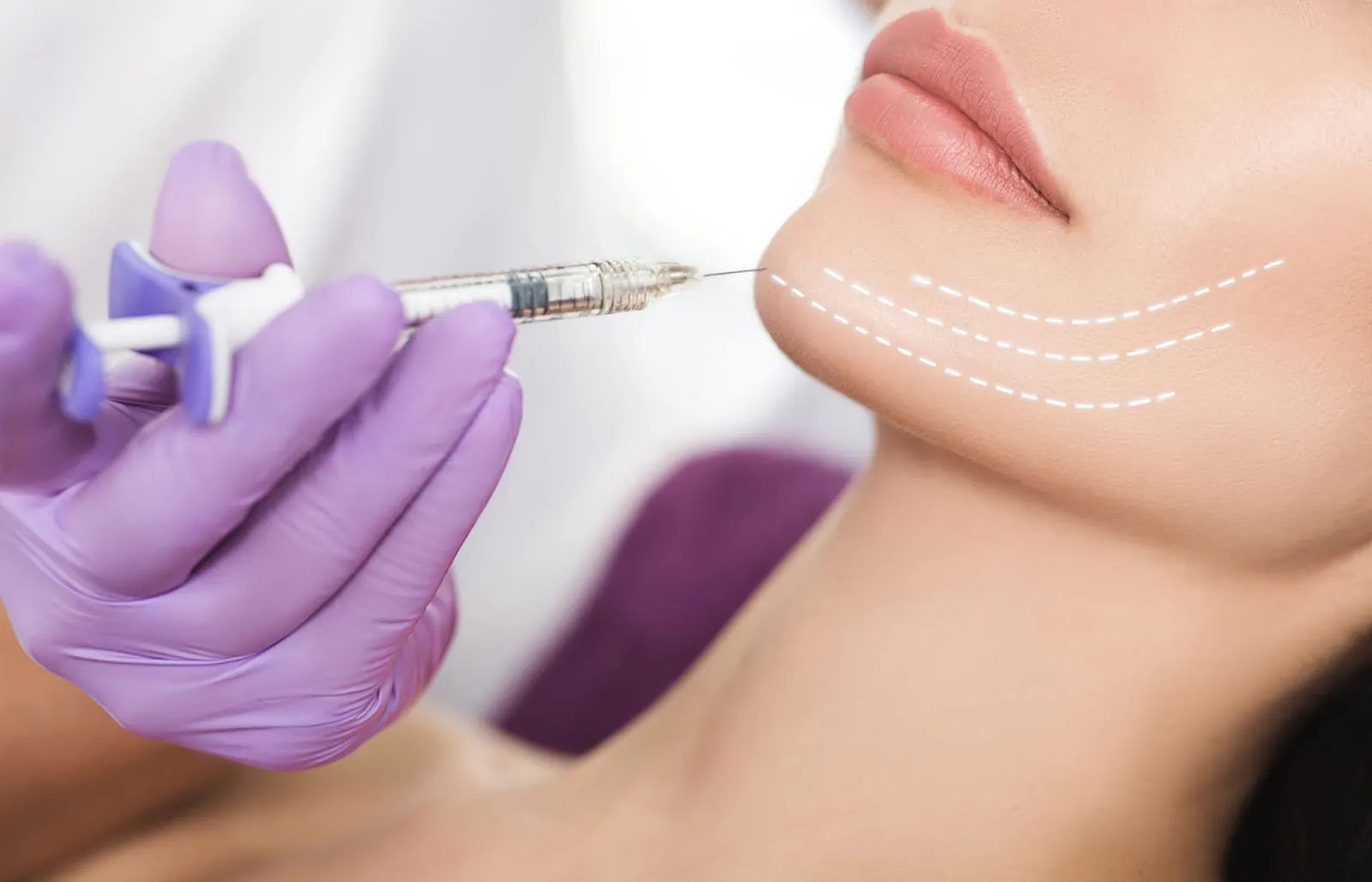 Facial profile and nasal aesthetics — rhinoplasty education.