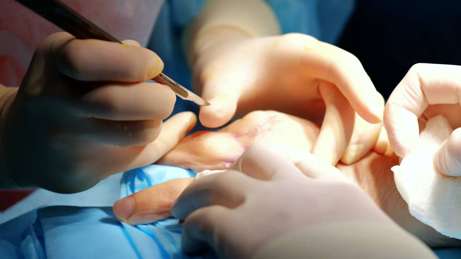 Reconstructive surgery and lymphatic treatment concept.